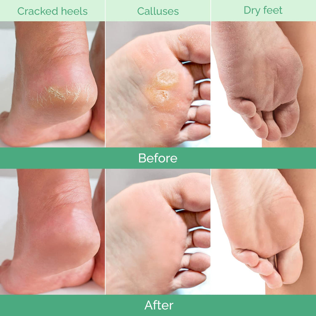 PLANTIFIQUE Foot Peeling Mask, Dermatologically Tested