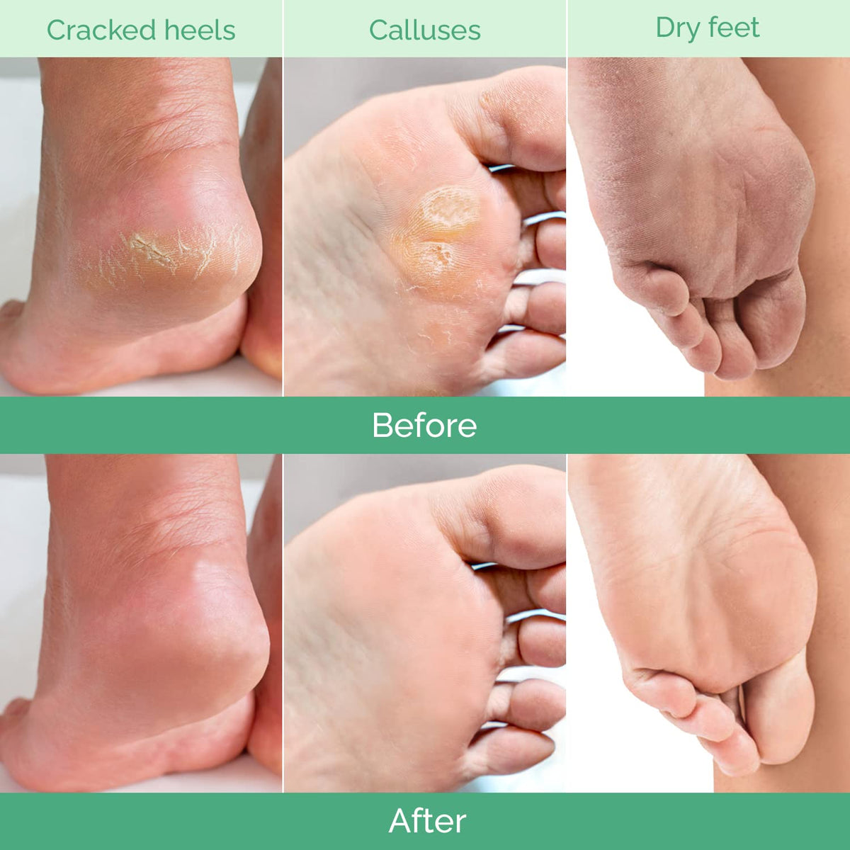 PLANTIFIQUE Foot Peeling Mask, Dermatologically Tested