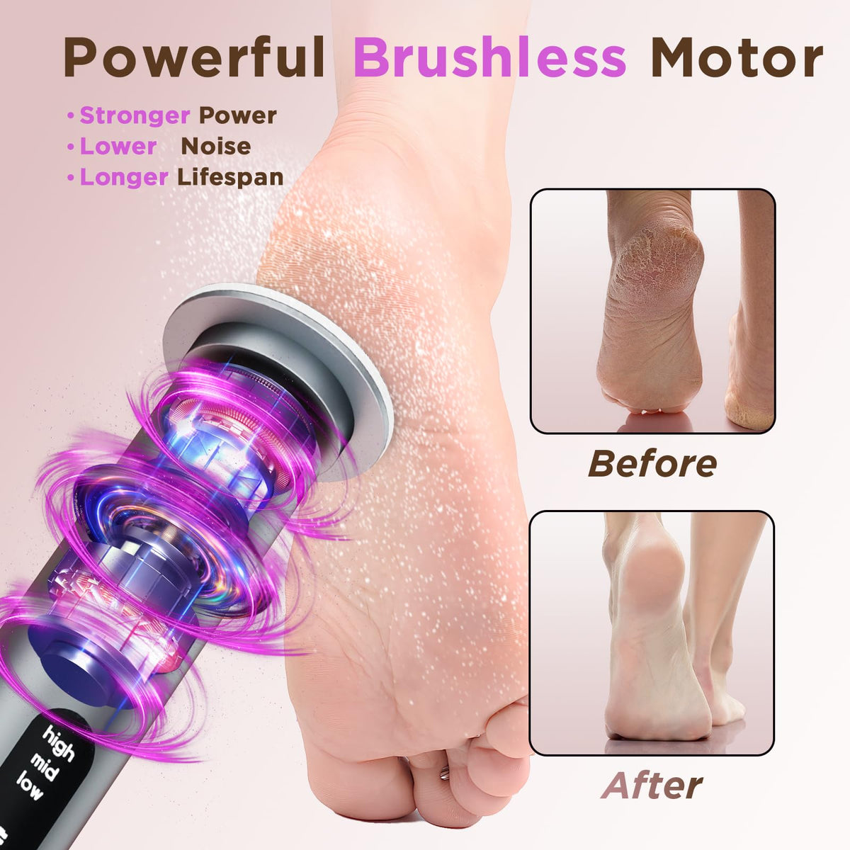 Electric Foot Callus Remover with Nano-Glass Head and Sandpaper Discs