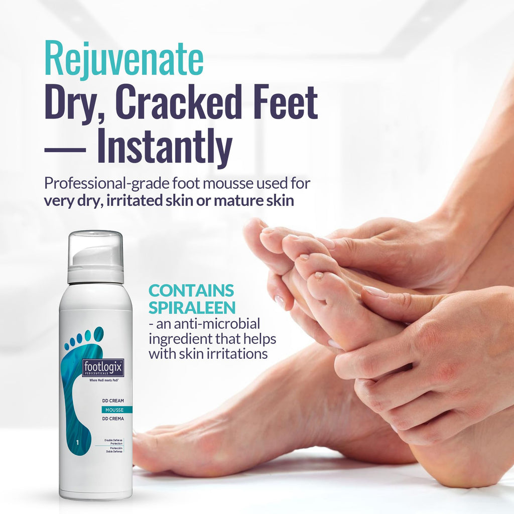 Footlogix DD Cream Mousse Foot & Body Moisturizer with Urea, Aloe & Vitamin E