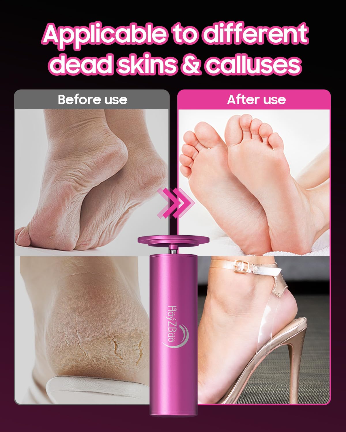 HayZBao Electric Foot Callus Remover with Adjustable Speed