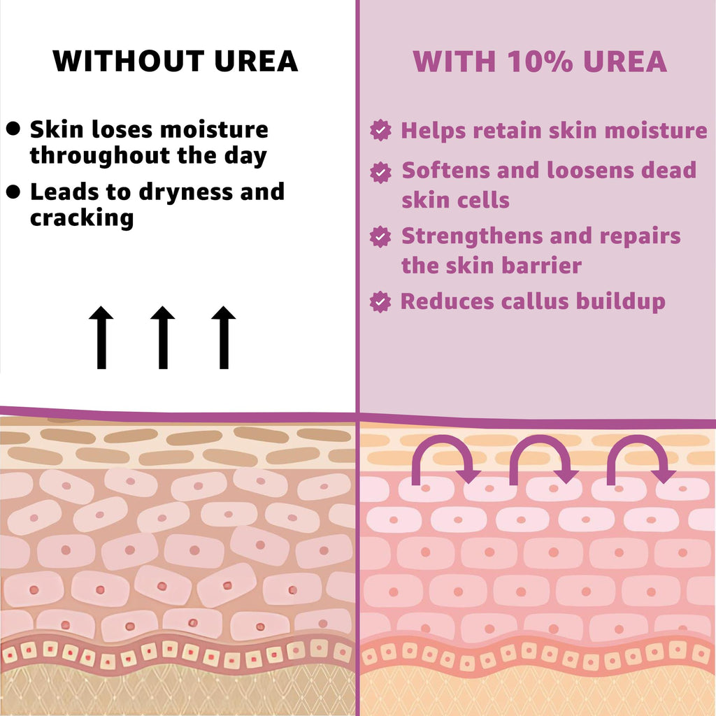 10% Urea Cream with Aloe Vera, Jojoba Oil & Salicylic Acid, 150ml