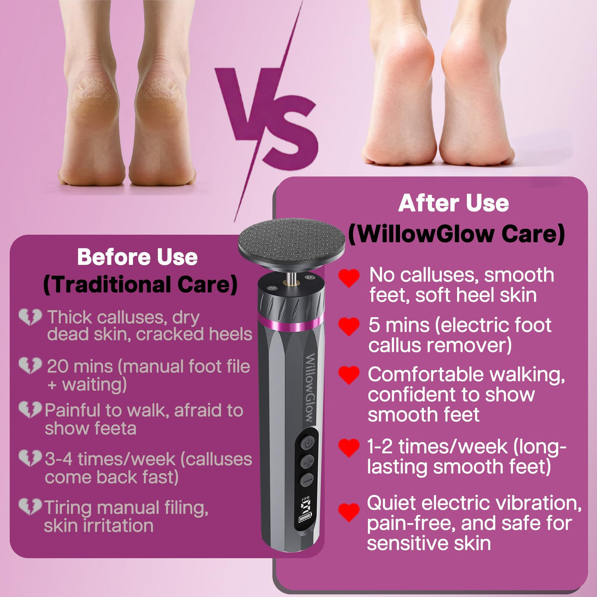 Professional Electric Foot Callus Remover with 9-Speed Cordless Foot File