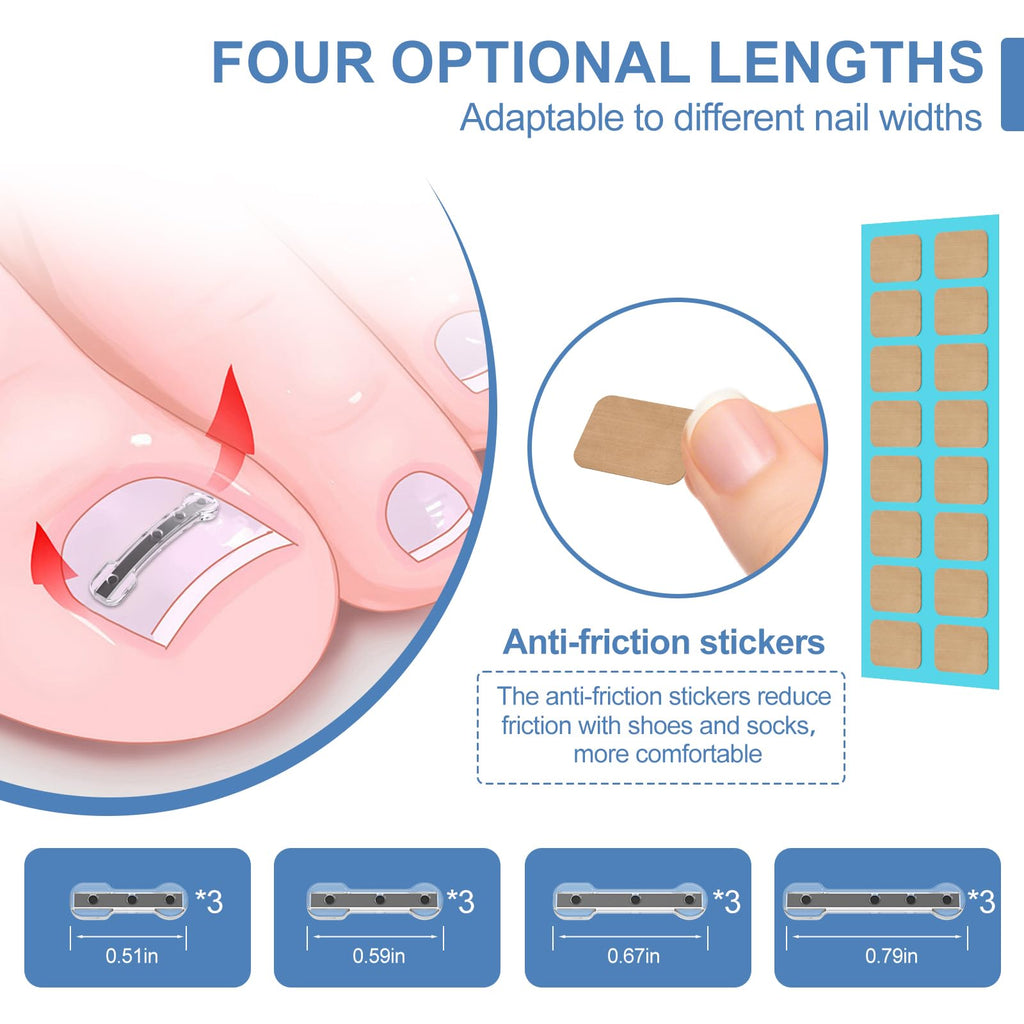 12-Piece Ingrown Toenail Corrector Strips with 4 Sizes