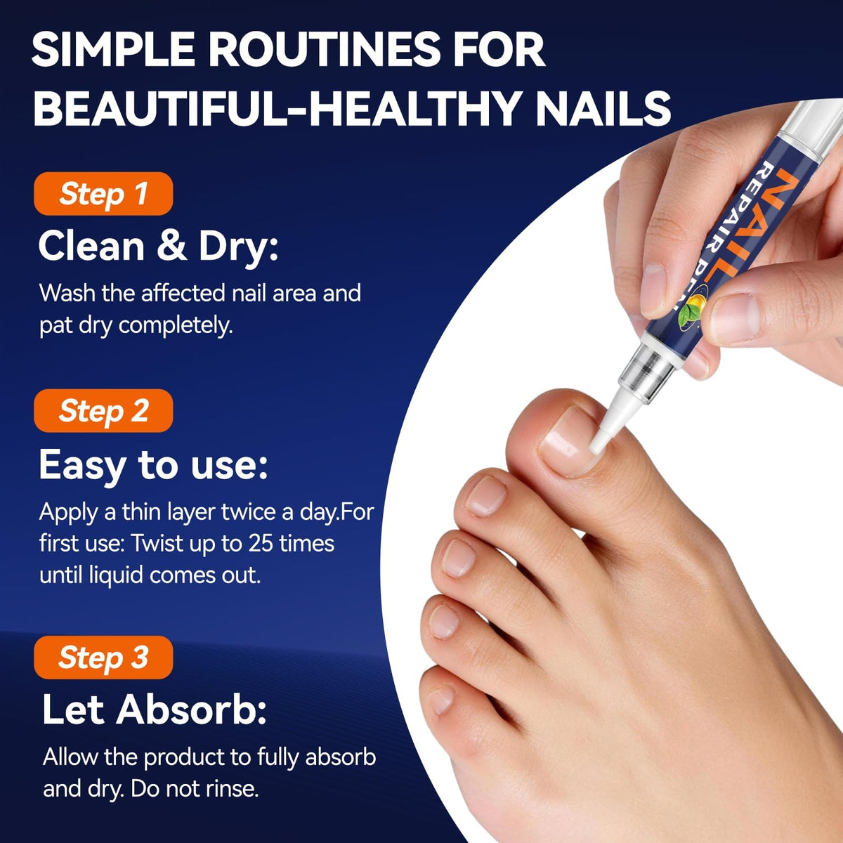Toenail Fungus Pen with 25% Undecylenic Acid, 5 Pens and Nail File