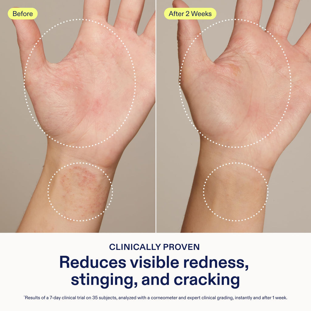 Skinfix Hand Relief Cream for Dry, Sensitive Skin, Fragrance-Free