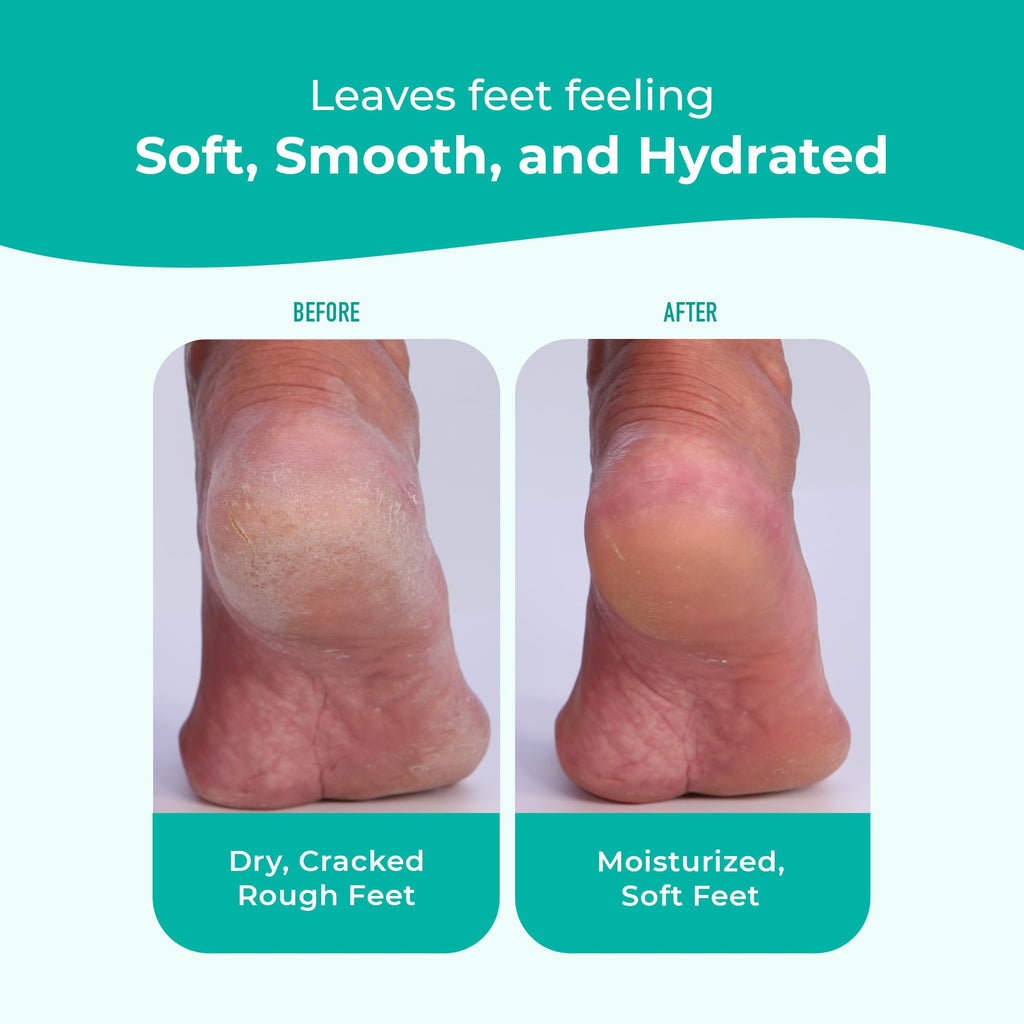 Richenna EZ Foot Care Cream with Urea, Foot File & Botanical Extracts
