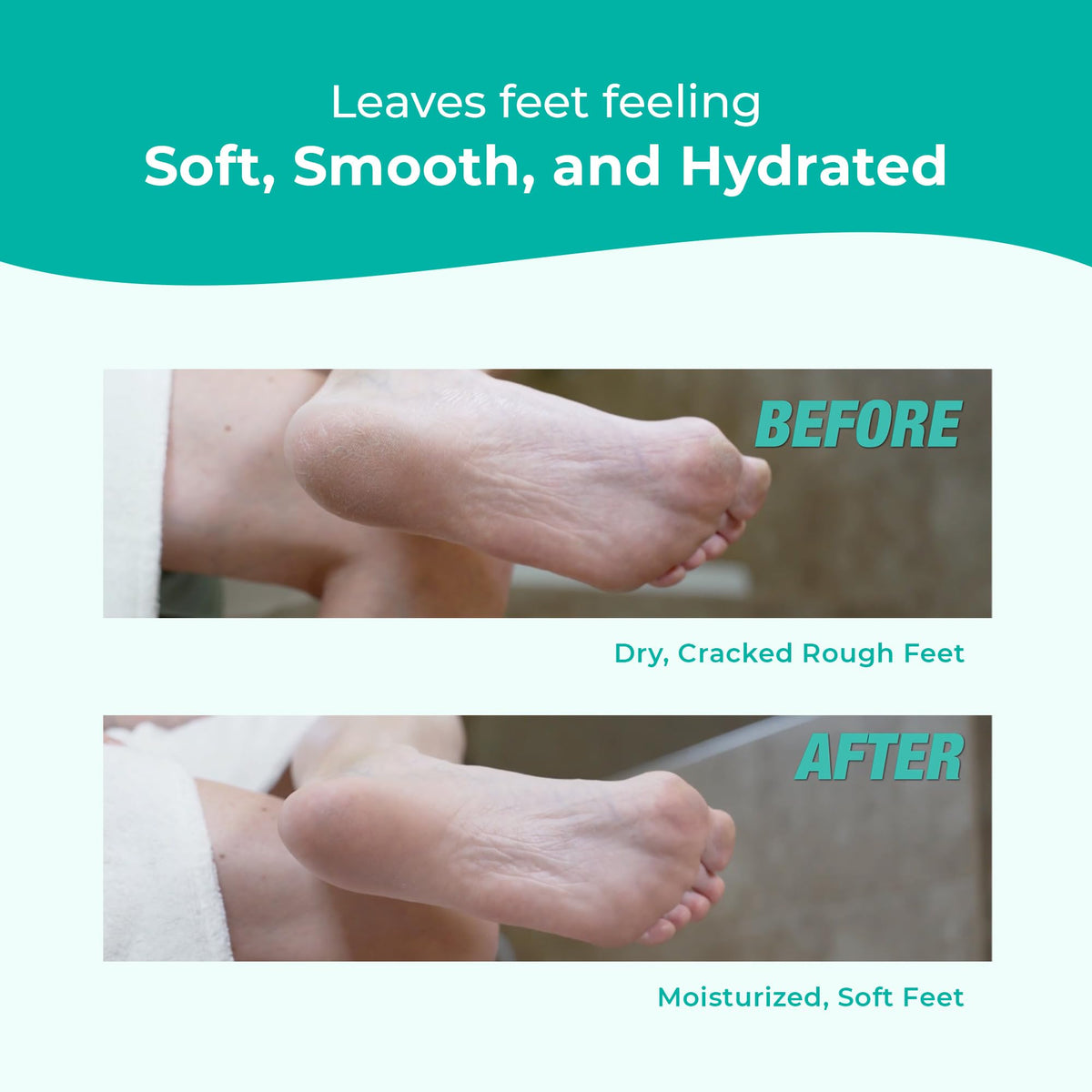 Richenna EZ Foot Care Cream with Urea, Foot File & Botanical Extracts