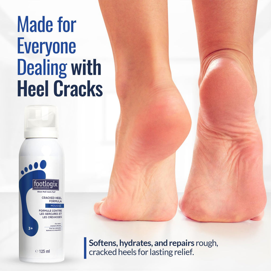 FOOTLOGIX Cracked Heel Formula Mousse with Urea, 4.23 oz