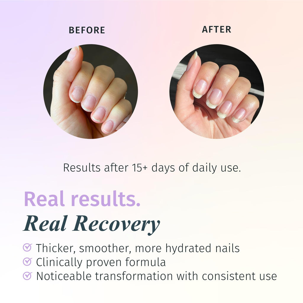 Duri Rejuvacote 2 Nail Growth Base and Top Coat