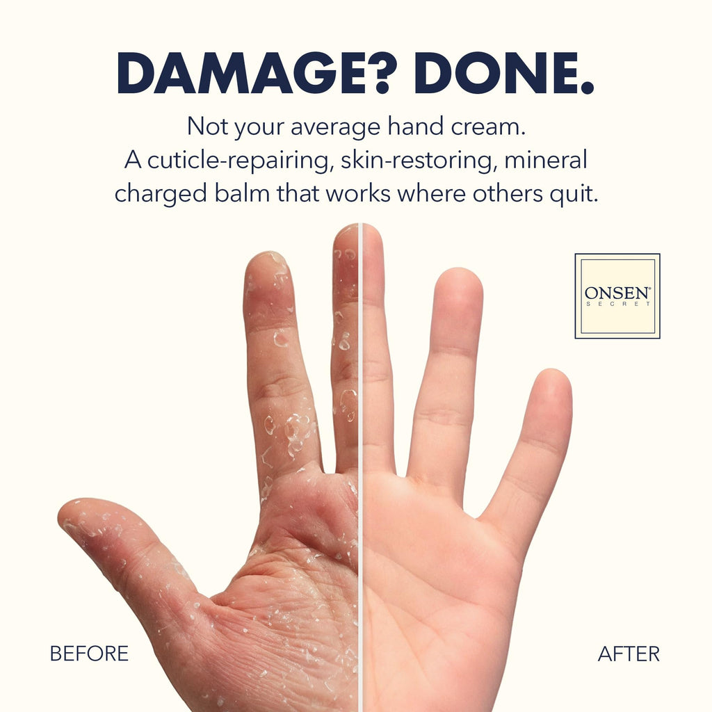 Onsen Nail & Cuticle Rescue Kit for Hydration and Nail Care