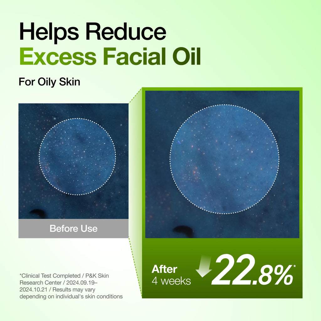 Anua Azelaic Acid 10 Hyaluron Redness Soothing Facial Serum