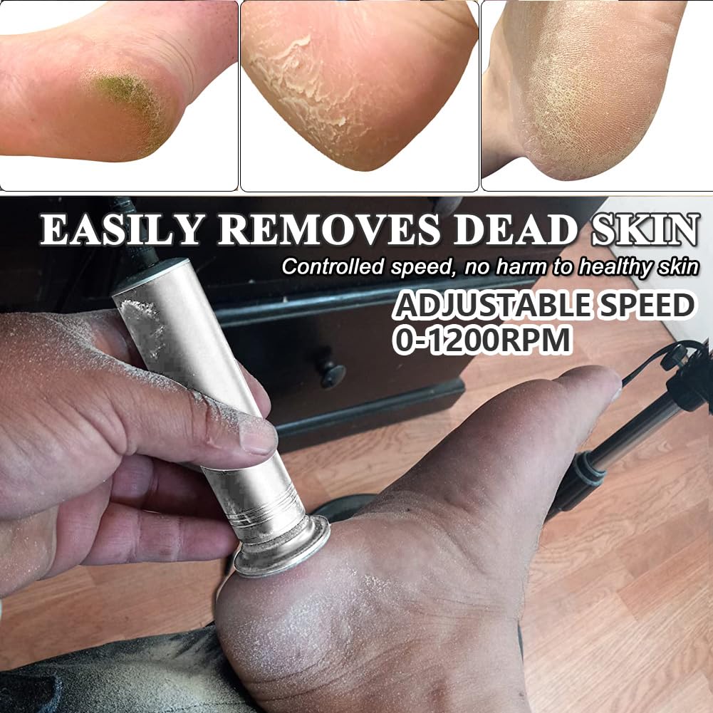 Electric Callus Remover Foot File with Adjustable Speed and 60 Discs