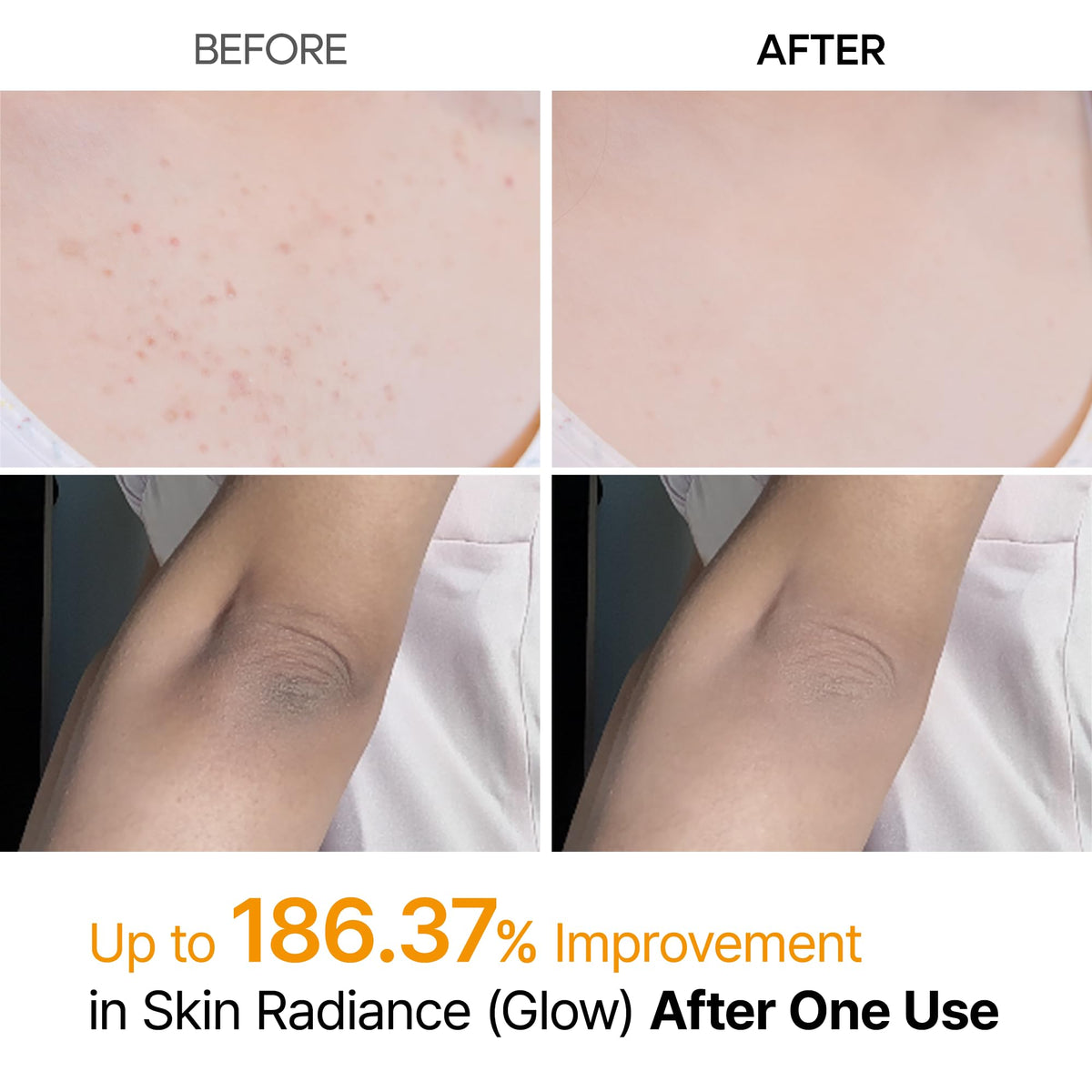 Dr.Melaxin Peel Shot Body Exfoliator Spray
