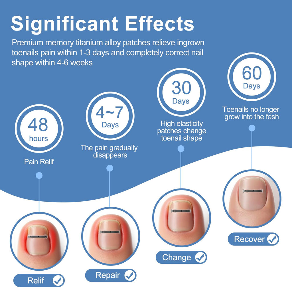 12-Piece Ingrown Toenail Corrector Strips with 4 Sizes