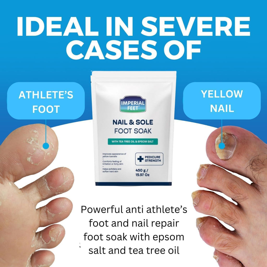 Imperial Feet Epsom Salt Foot Soak for Pedicure Foot Care