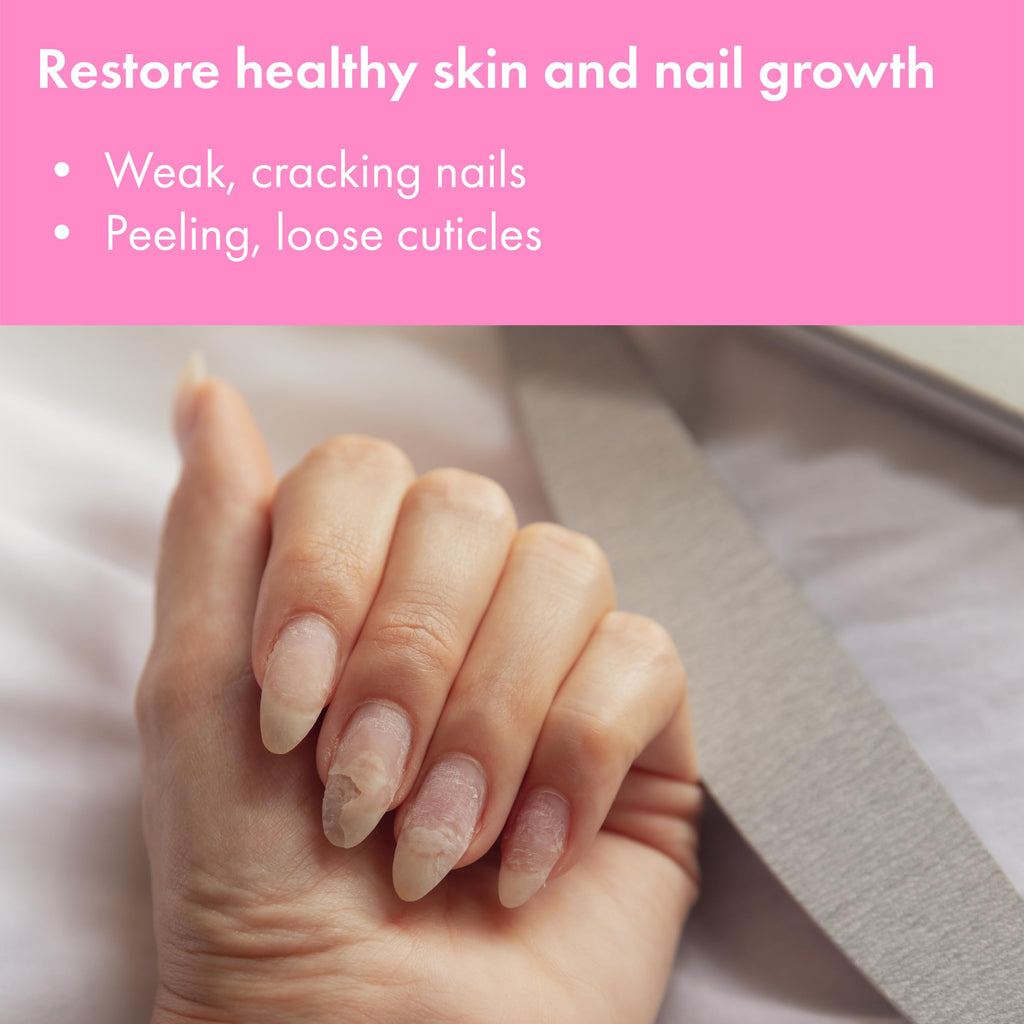 VITÉ20 Nail Clearing Gel with Apple, Lemon & Sugarcane Extracts