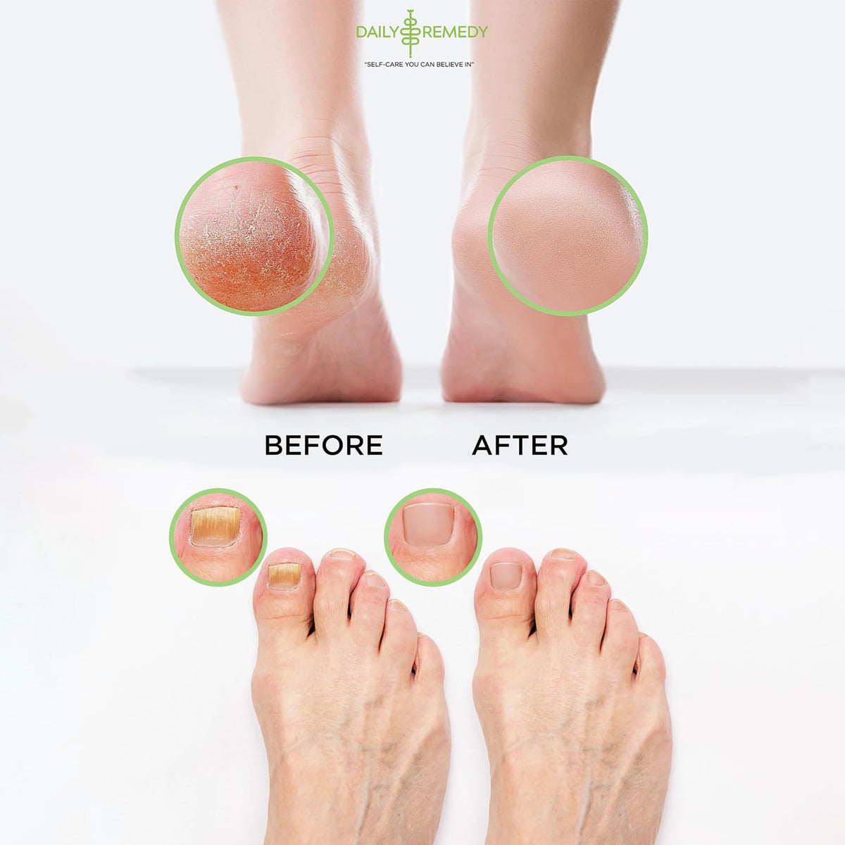 DAILY REMEDY Foot Soak Salts