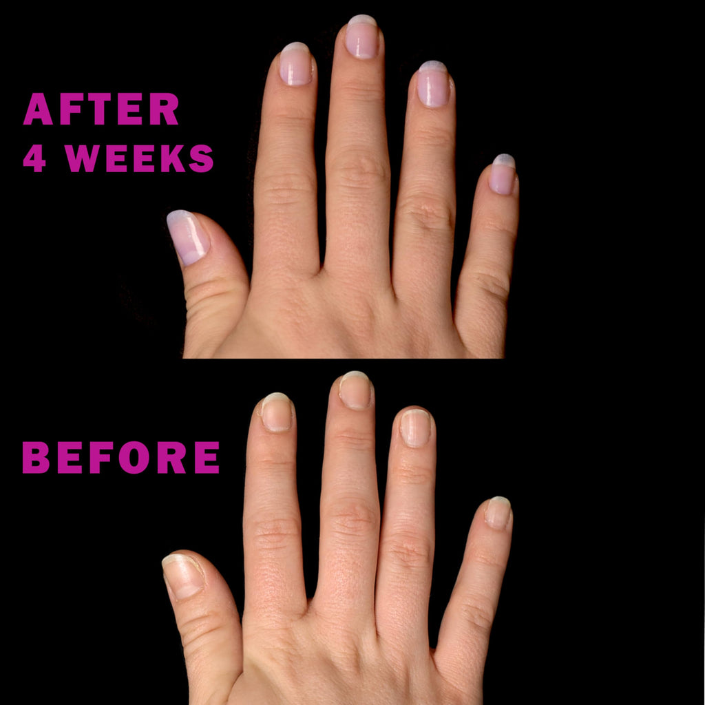 Perfect Formula 4-Piece Keratin Nail Strengthener Treatment Kit