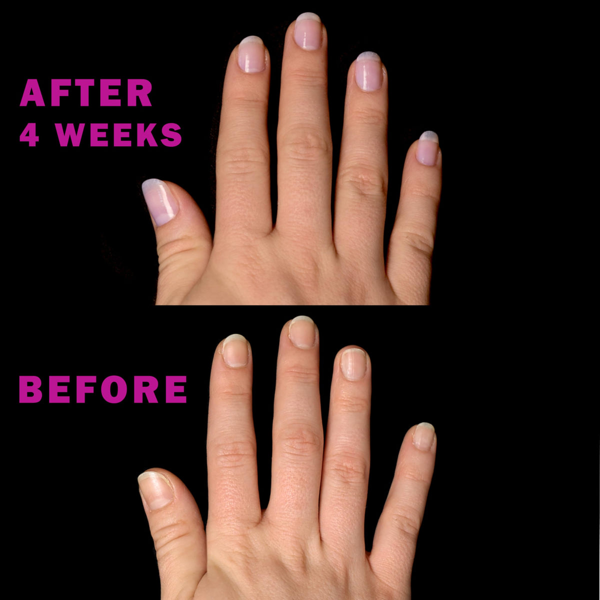 Perfect Formula 4-Piece Keratin Nail Strengthener Treatment Kit