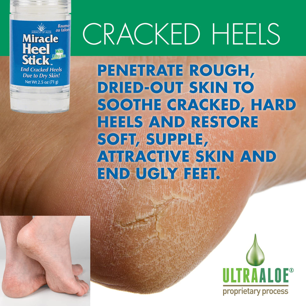 Miracle of Aloe Heel Stick for Dry, Cracked Heels