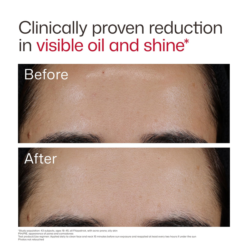 EltaMD UV Clear Face Sunscreen SPF 46, Oil-Free Broad Spectrum