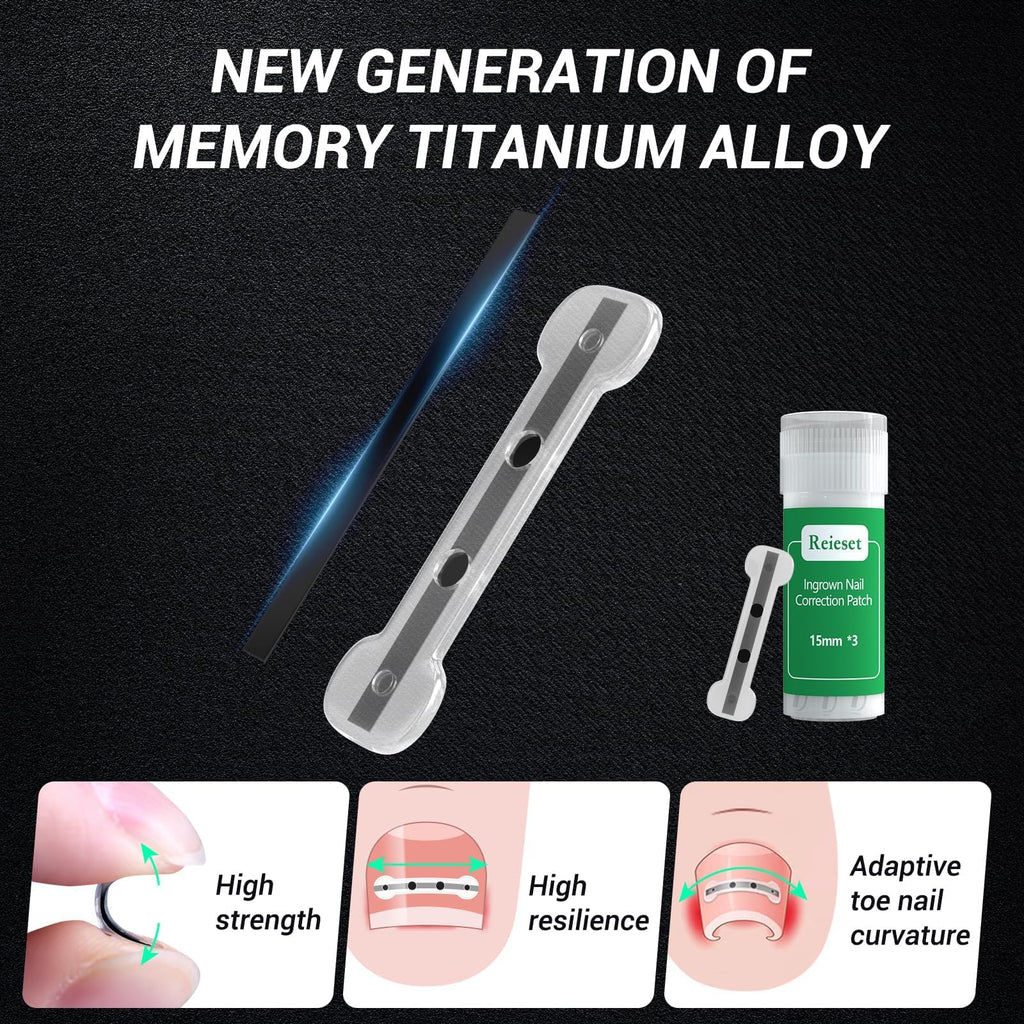 Reieset Titanium Alloy Ingrown Toenail Correction Patch