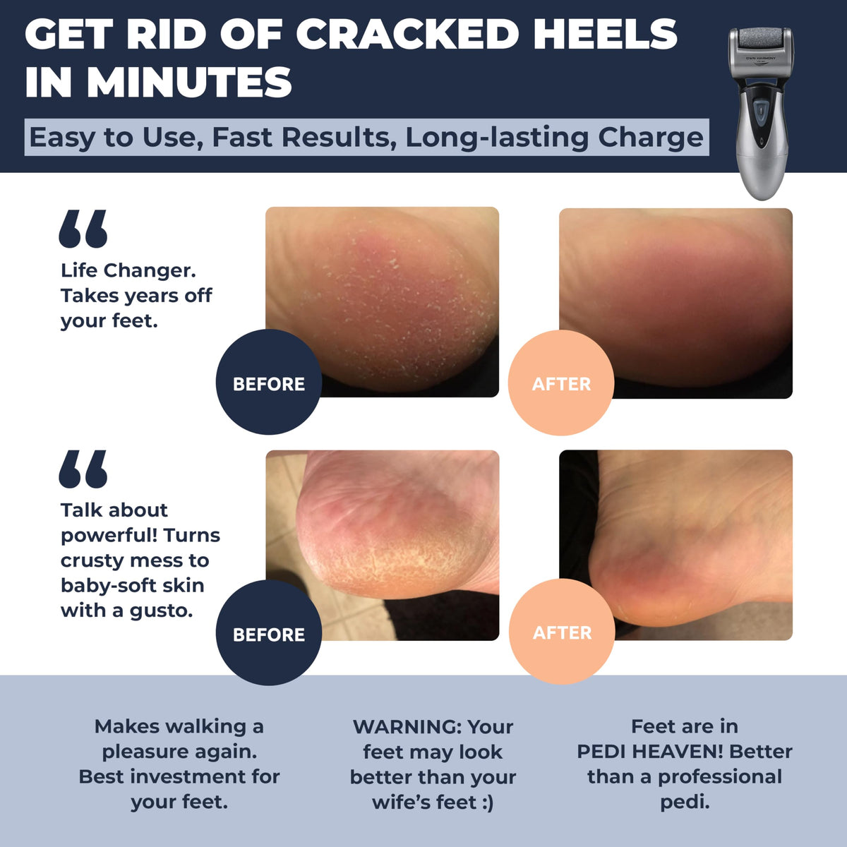 Own Harmony Electric Callus Remover, Rechargeable Foot File