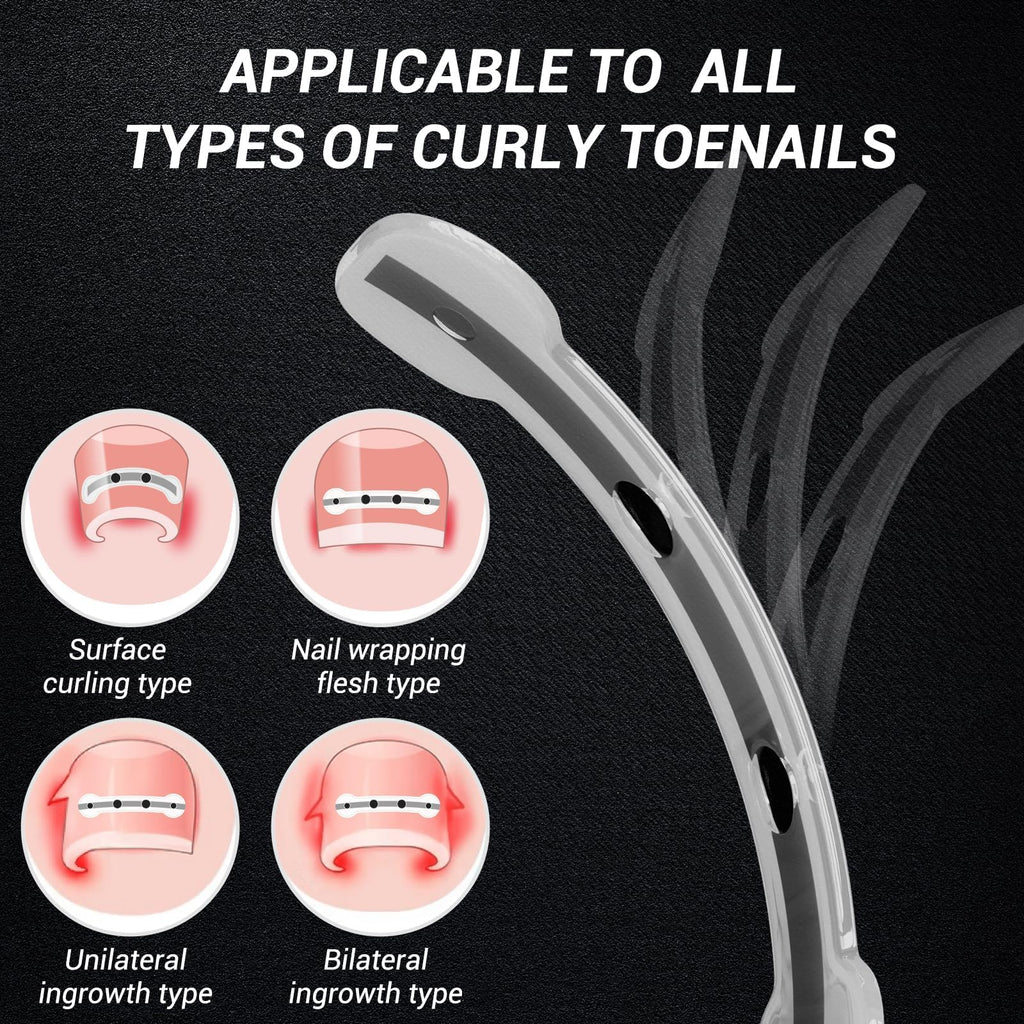 Reieset Titanium Alloy Ingrown Toenail Correction Patch