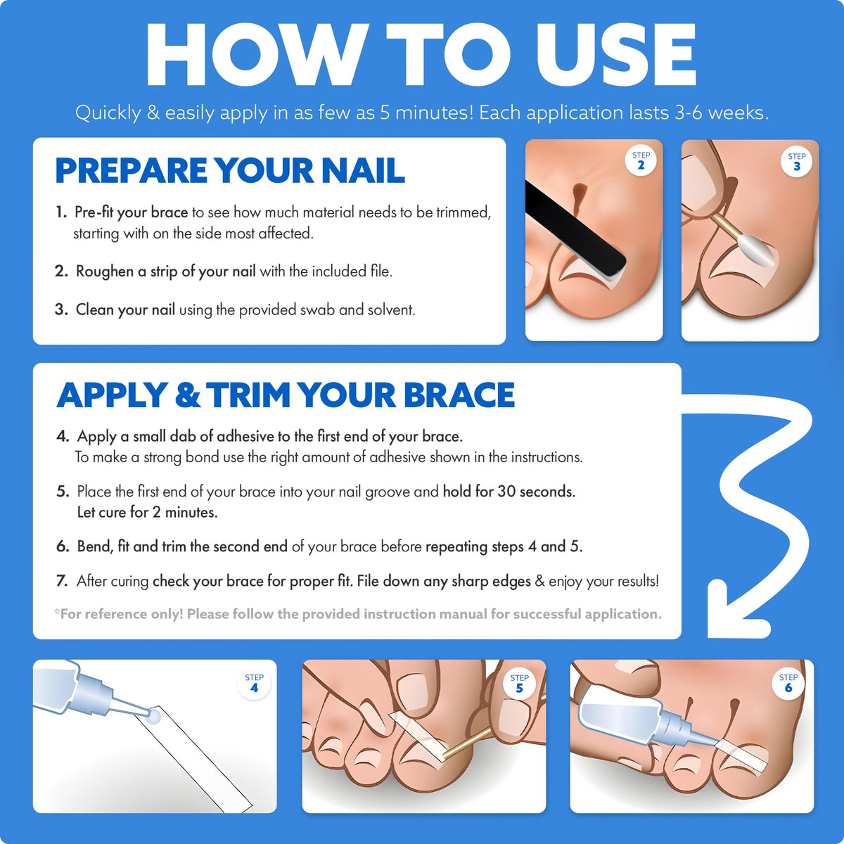 CurveCorrect Ingrown Toenail Treatment Kit with Clear Nail Braces