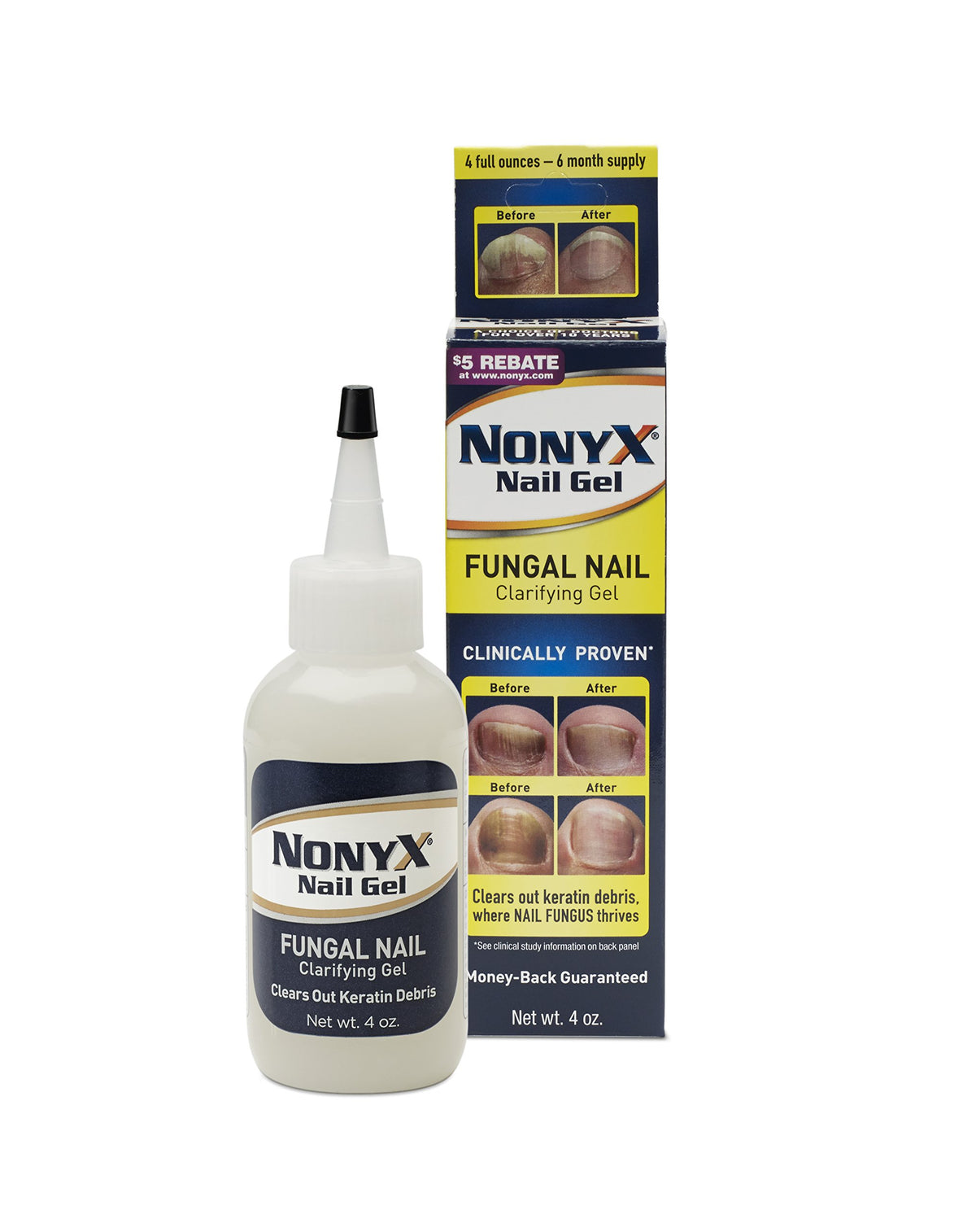 NonyX Nail Gel for Clear, Healthy-Looking Nails, 4 oz, 2 Pack