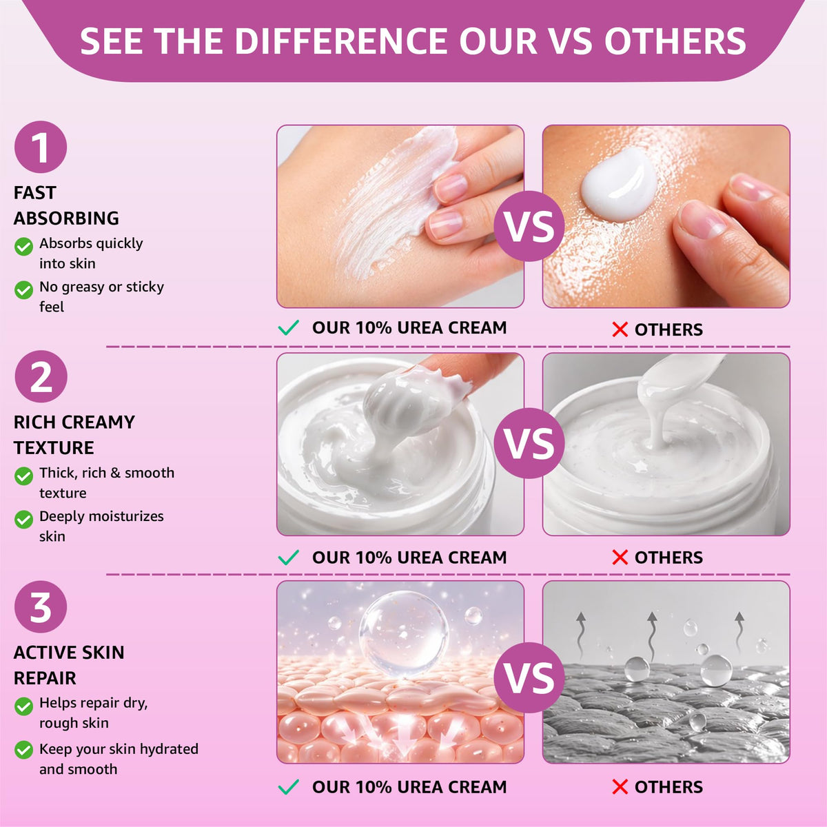 10% Urea Cream with Aloe Vera, Jojoba Oil & Salicylic Acid, 150ml