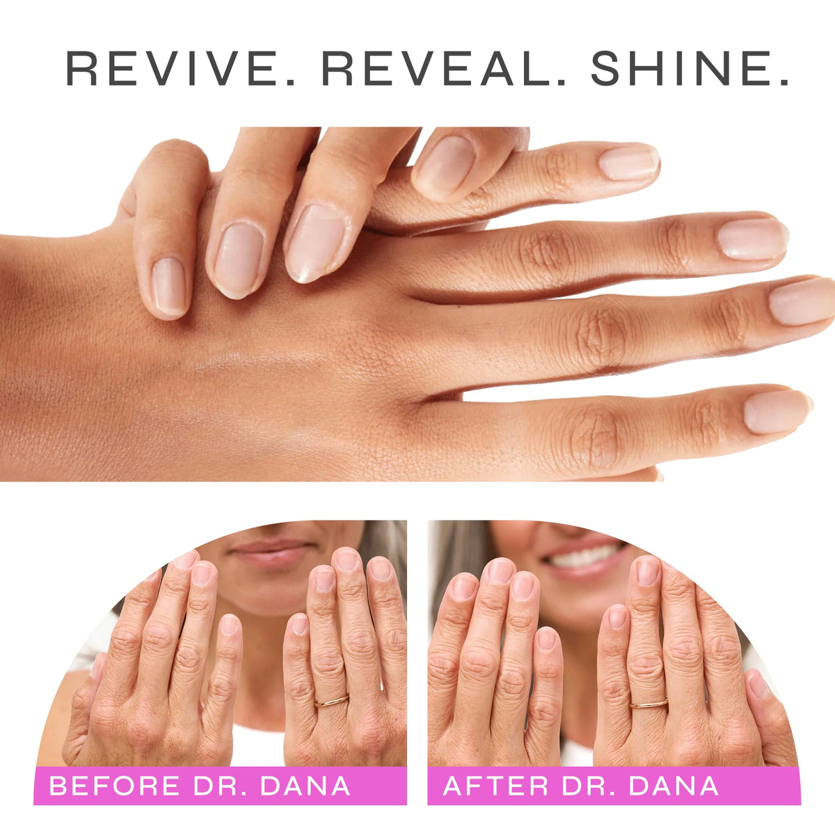 Dr. Dana Nail Repair Kit with Glycolic Acid for Stronger, Shiny Nails