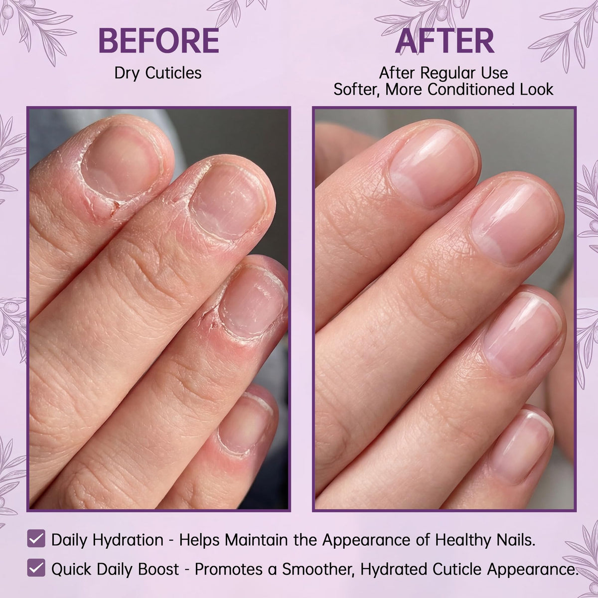 Hydrating Cuticle Oil Pen with Jojoba Oil, Vitamin E, Tea Tree & Squalane