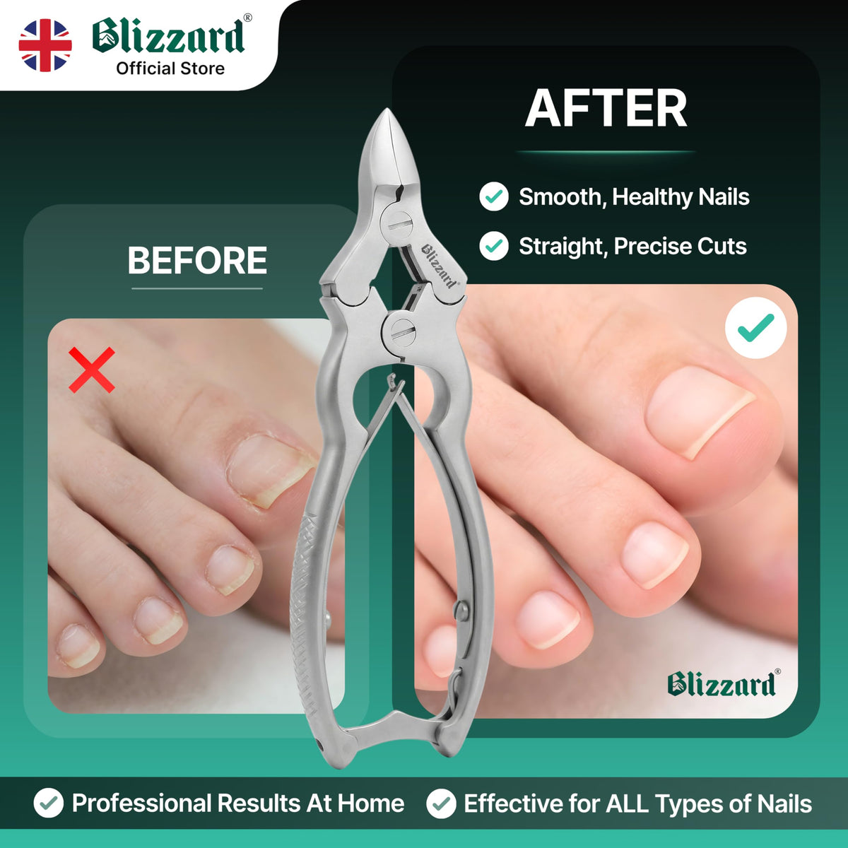 Blizzard Heavy Duty Toenail Clippers for Thick Nails