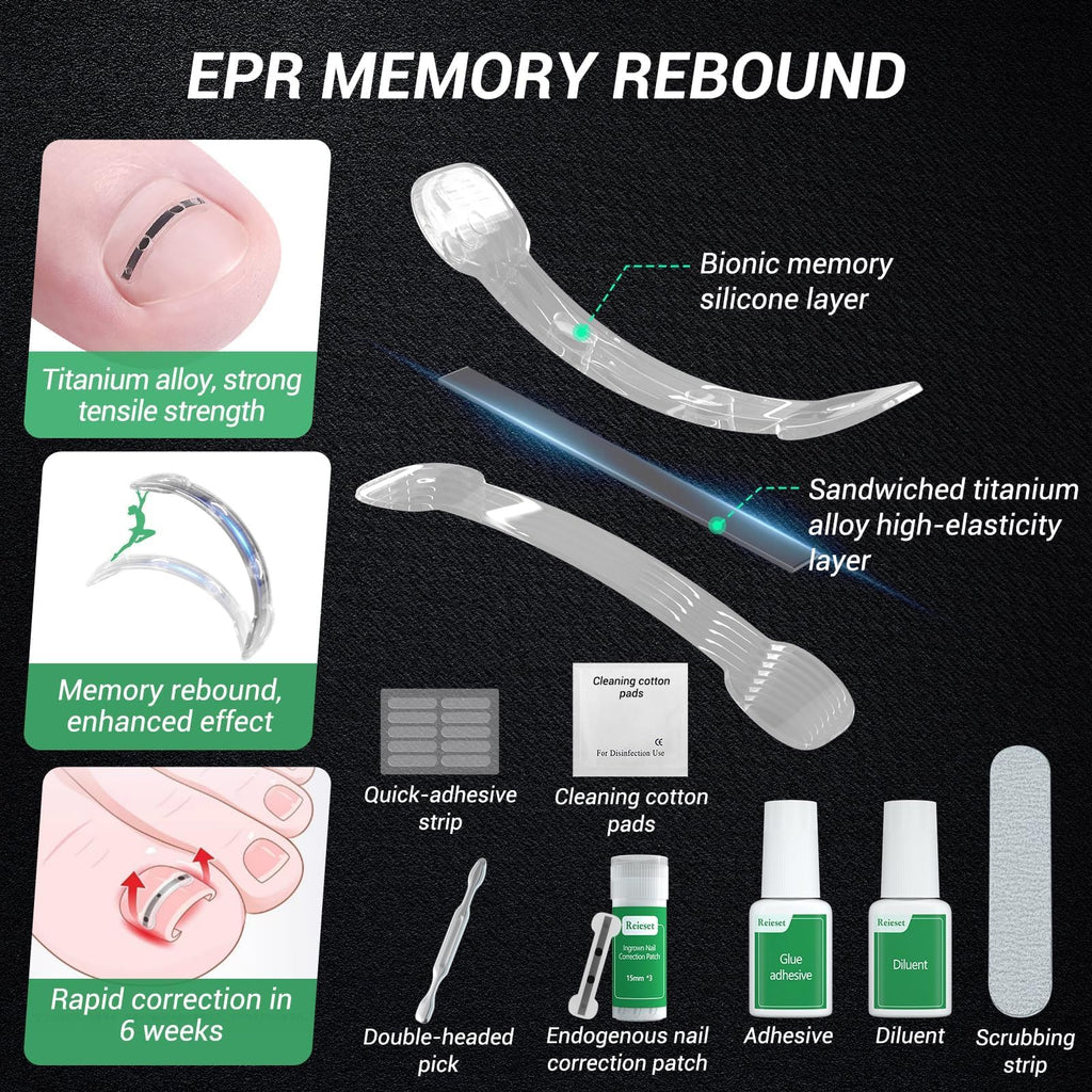 Reieset Titanium Alloy Ingrown Toenail Correction Patch