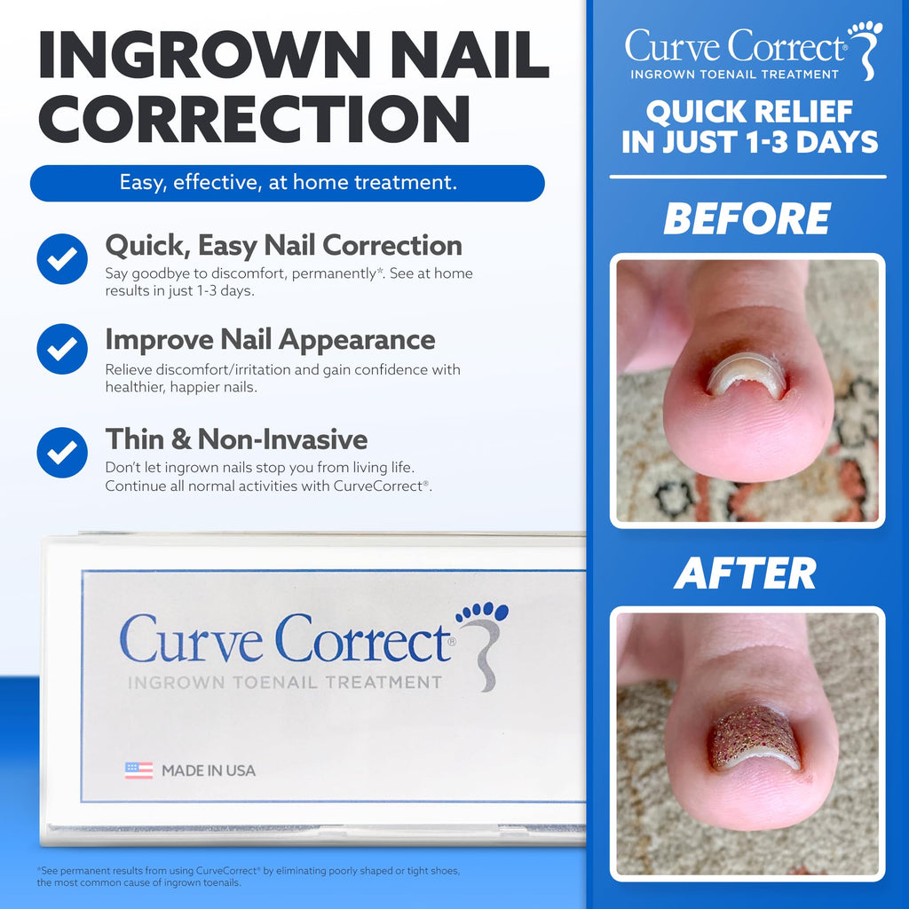 CurveCorrect Ingrown Toenail Treatment Kit with Clear Nail Braces