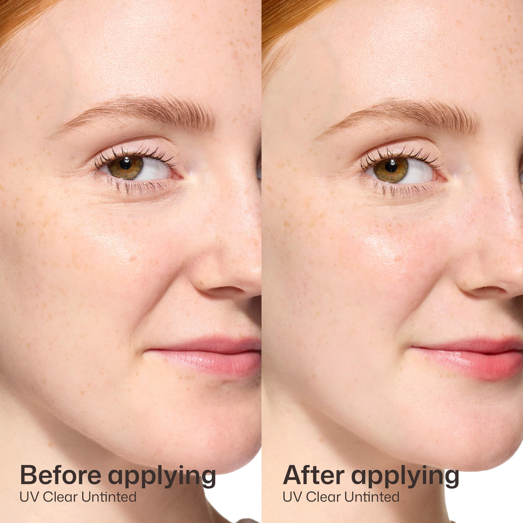 EltaMD UV Clear Face Sunscreen SPF 46, Oil-Free Broad Spectrum