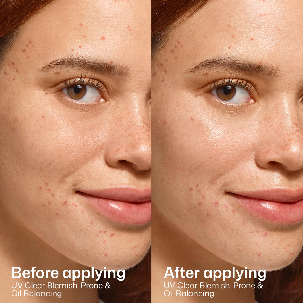 EltaMD UV Clear Face Sunscreen SPF 46, Oil-Free Broad Spectrum