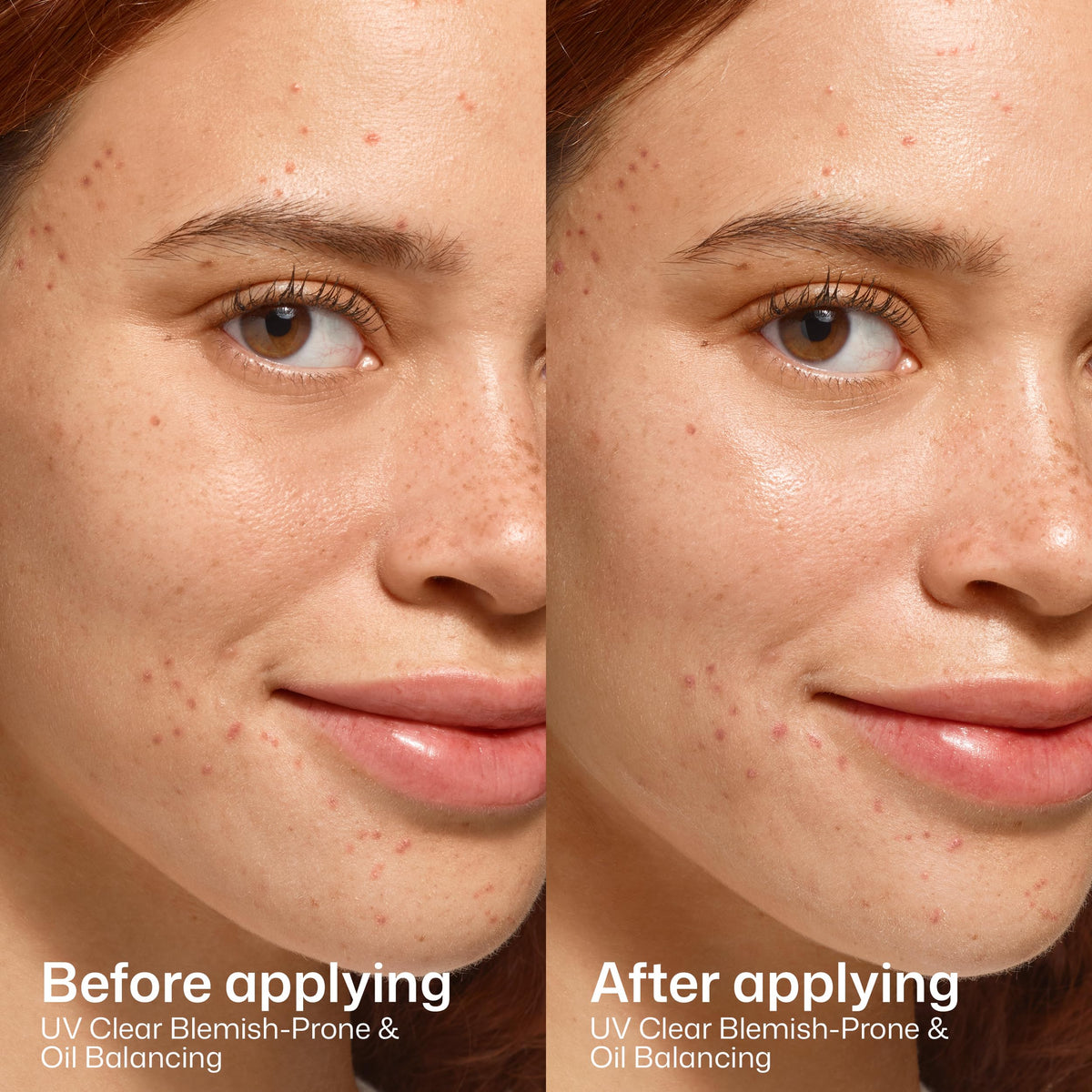 EltaMD UV Clear Face Sunscreen SPF 46, Oil-Free Broad Spectrum