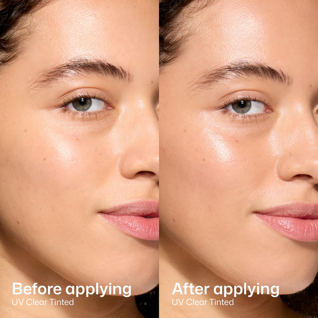 EltaMD UV Clear Face Sunscreen SPF 46, Oil-Free Broad Spectrum
