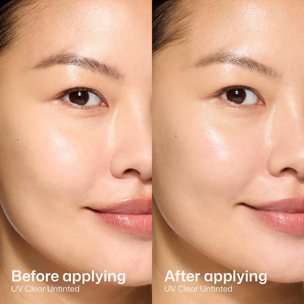 EltaMD UV Clear Face Sunscreen SPF 46, Oil-Free Broad Spectrum
